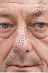 Nose Man White Chubby Wrinkles
