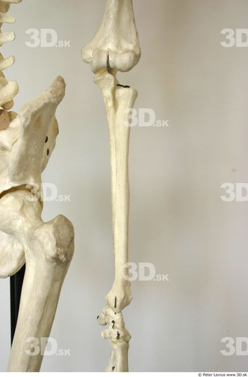 Forearm Skeleton