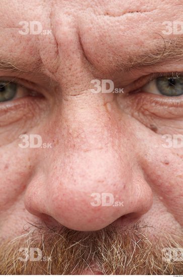 Nose Man White Chubby Wrinkles