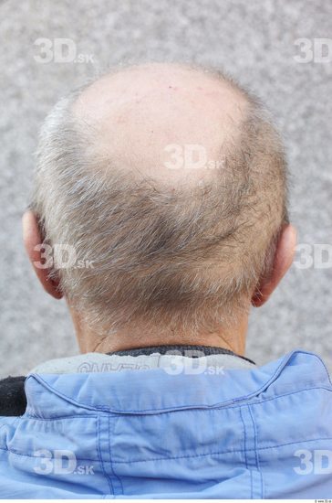 Hair Man White Average Bald