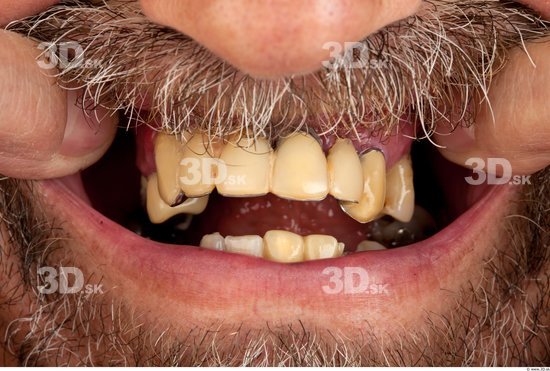 Teeth Average Bearded Studio photo references