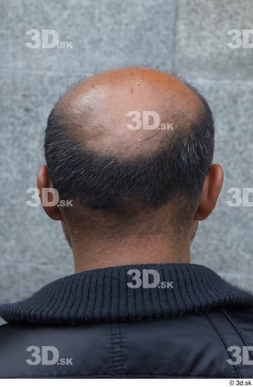 Head Hair Man White Casual Average Bald Street photo references