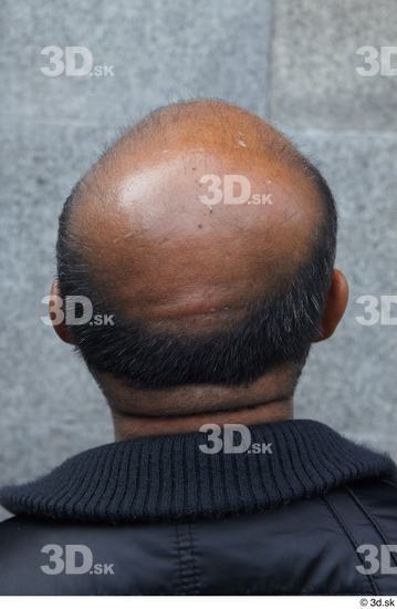 Head Hair Man White Casual Average Bald Street photo references