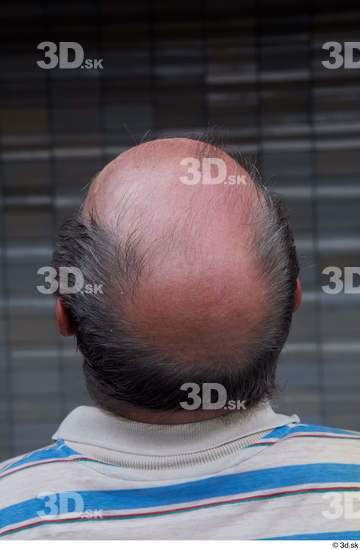 Head Hair Man White Casual Average Bald Street photo references