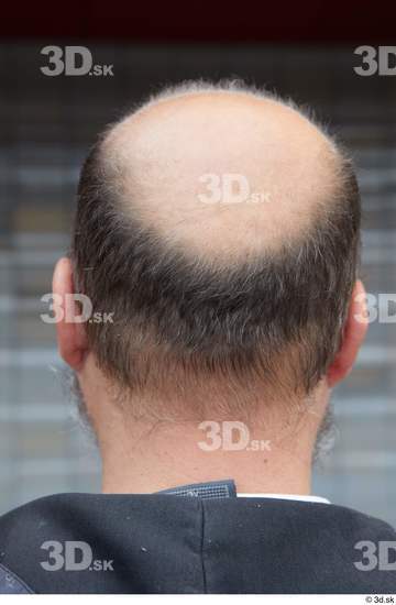 Head Hair Man White Casual Average Bald Street photo references