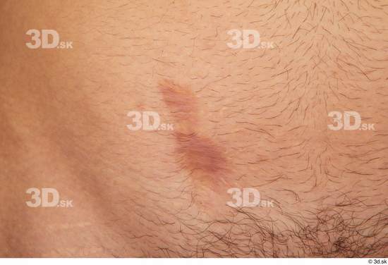 Skin Man Scar Nude Slim Studio photo references