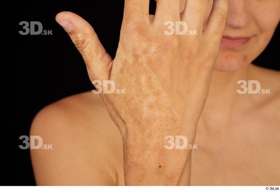 Tiny Tina hand scar  jpg