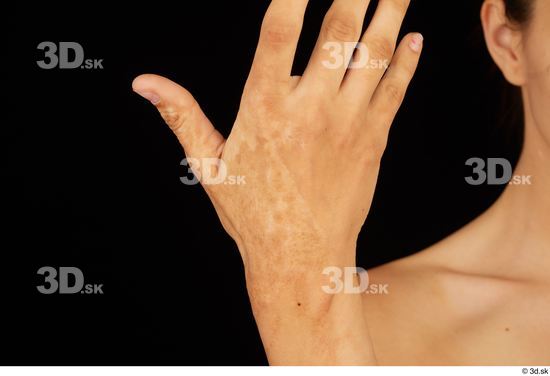 Tiny Tina hand scar  jpg