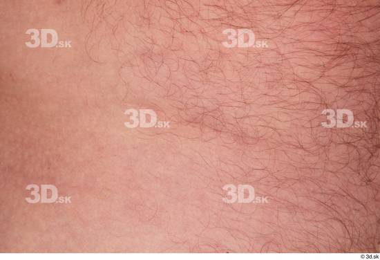 Neeo hairy nude scar skin  jpg