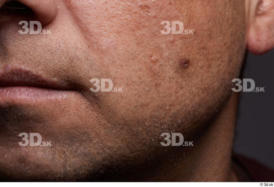 Face Mouth Cheek Skin Man Birthmarks Chubby Studio photo references