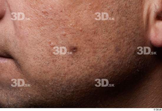 Face Cheek Skin Man Birthmarks Chubby Studio photo references