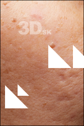  HD Face Skin Khulana Delbee 