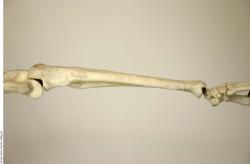 Skeleton