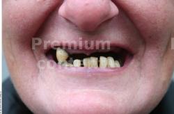 Teeth Woman White Slim