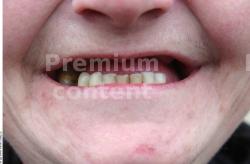 Teeth Woman White Chubby