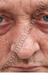 Nose Man White Overweight Wrinkles