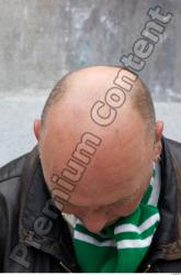 Hair Man White Chubby Bald
