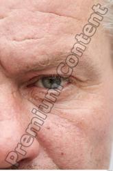 Eye Man White Chubby Wrinkles