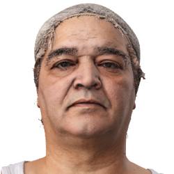 Abdul Gyrot Raw Head Scan