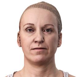 Emilia Parker Raw Head Scan